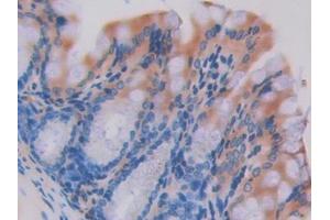 Used in DAB staining on fromalin fixed paraffin- embedded intestine tissue (HEXB anticorps  (AA 294-435))