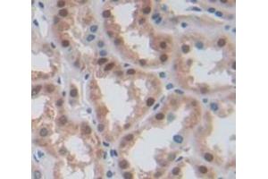 IHC-P analysis of Human Tissue, with DAB staining. (RBM38 anticorps  (AA 25-207))