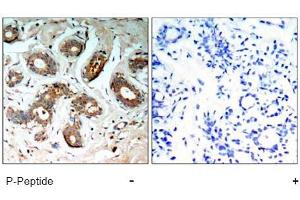 Image no. 1 for anti-14-3-3 zeta (YWHAZ) (pSer58) antibody (ABIN196916) (14-3-3 zeta anticorps  (pSer58))