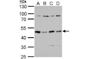 WB Image PKA R2 antibody detects PKA R2 protein by Western blot analysis. (PRKAR2A anticorps  (Center))