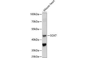 Western blot analysis of extracts of mouse heart, using SOX7 antibody (ABIN7270576) at 1:1000 dilution. (SOX7 anticorps  (AA 250-350))