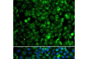 Immunofluorescence analysis of MCF-7 cells using TMLHE Polyclonal Antibody (TMLHE anticorps)