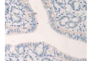 Detection of GDF5 in Mouse Small intestine Tissue using Polyclonal Antibody to Growth Differentiation Factor 5 (GDF5)