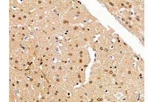 ABIN7094648 and ABIN7098699 at 1/100 staining Rat brain tissue by IHC-P. (H2AFY2 anticorps  (C-Term))