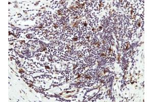 IHC-P Image Immunohistochemical analysis of paraffin-embedded Human lymph tissue, using HICE1 , antibody at 1:50 dilution. (NYS48/HAUS8 anticorps)
