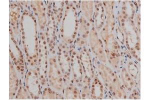 ABIN6267333 at 1/200 staining Human kidney tissue sections by IHC-P.