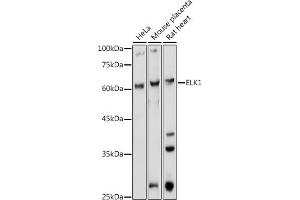 Western blot analysis of extracts of various cell lines, using ELK1 antibody (ABIN1679704, ABIN3015328, ABIN3015329 and ABIN6213987) at 1:1000 dilution. (ELK1 anticorps  (AA 90-250))