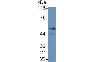 Detection of LSP1 in Human Lung lysate using Polyclonal Antibody to Lymphocyte Specific Protein 1 (LSP1) (LSP1 anticorps  (AA 127-331))