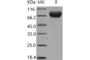 Western Blotting (WB) image for Selectin E (SELE) (Active) protein (His tag) (ABIN7197871) (Selectin E/CD62e Protein (His tag))