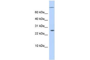 WB Suggested Anti-ARID5A Antibody Titration:  0.