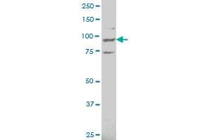 ATP6V0A2 polyclonal antibody (A01), Lot # 051214JC01 Western Blot analysis of ATP6V0A2 expression in HL-60 .