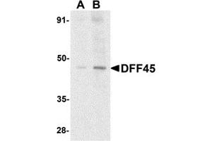 Western Blotting (WB) image for anti-DNA Fragmentation Factor, 45kDa, alpha Polypeptide (DFFA) (N-Term) antibody (ABIN1031352) (DFFA anticorps  (N-Term))