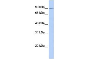 WB Suggested Anti-XYLT2 Antibody Titration:  0. (XYLT2 anticorps  (C-Term))