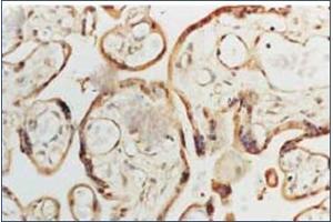 Image no. 1 for anti-Superoxide Dismutase 1, Soluble (SOD1) antibody (ABIN264856) (SOD1 anticorps)
