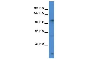 Western Blot showing GABBR2 antibody used at a concentration of 1 ug/ml against Hela Cell Lysate (GABBR2 anticorps  (C-Term))