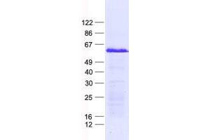Validation with Western Blot