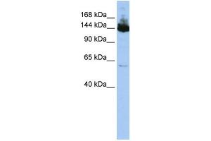 WB Suggested Anti-SYMPK  Antibody Titration: 0. (Symplekin anticorps  (Middle Region))