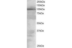 Western Blotting (WB) image for Vav 2 Guanine Nucleotide Exchange Factor (VAV2) peptide (ABIN370136) (Vav 2 Guanine Nucleotide Exchange Factor (VAV2) Peptide)