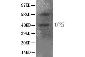 Anti-CCR5 antibody, IHC(P)All lanes: Anti CCR5  at 0. (CCR5 anticorps  (N-Term))