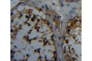 IHC-P analysis of testis tissue, with DAB staining. (PAG1 anticorps  (AA 138-357))