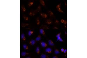 Immunofluorescence analysis of U-2 OS cells using SEC14L2 Polyclonal Antibody (ABIN6132639, ABIN6147484, ABIN6147485 and ABIN6214889) at dilution of 1:100 (40x lens). (SEC14L2 anticorps  (AA 60-270))