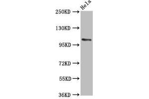 Western Blot Positive WB detected in: Hela whole cell lysate All lanes: PAM antibody at 5. (PAM anticorps  (AA 338-497))