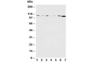Western blot testing of NMDAR1 antibody and Lane 1:  rat brain
