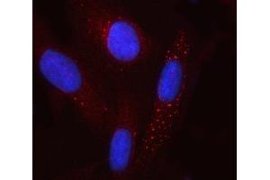 IF analysis of GCM1 using anti-GCM1 antibody (ABIN7600391). (GCM1 anticorps  (AA 188-436))
