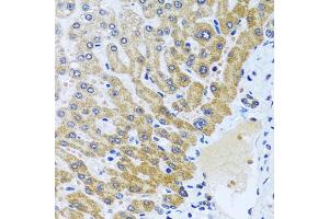 Immunohistochemistry of paraffin-embedded human liver using CPA6 antibody. (CPA6 anticorps)