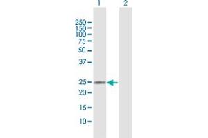 Western Blot analysis of RAB37 expression in transfected 293T cell line by RAB37 MaxPab polyclonal antibody. (RAB37 anticorps  (AA 1-223))