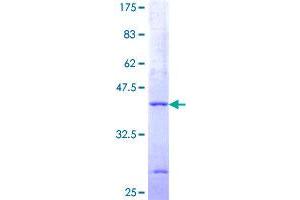 Image no. 1 for Phosphatidylinositol Glycan Anchor Biosynthesis, Class P (PIGP) protein (GST tag) (ABIN1315029)