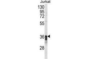 Western blot analysis of TM173 Antibody (C-term) in Jurkat cell line lysates (35 µg/lane). (STING/TMEM173 anticorps  (C-Term))