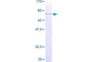 Image no. 1 for CD4 (CD4) (AA 1-458) protein (GST tag) (ABIN1348638)