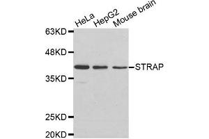 Western Blotting (WB) image for anti-Serine/threonine Kinase Receptor Associated Protein (STRAP) antibody (ABIN1876993) (STRAP anticorps)