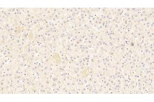 Detection of C4B in Human Liver Tissue using Polyclonal Antibody to Complement C4-B (C4B) (C4B anticorps  (AA 19-333))