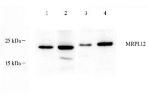 Western blot analysis of MRPL12 (ABIN7074638) at dilution of 1: 1000,Lane 1: Mouse stomach tissue lysate,Lane 2: Mouse colon tissue lysate,Lane 3: Rat breast tissue lysate,Lane 4: Rat stomach tissue lysate (MRPL12 anticorps)