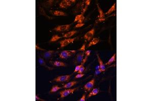 Immunofluorescence analysis of C6 cells using TENM1 antibody (ABIN7270767) at dilution of 1:100. (ODZ1/Teneurin 1 anticorps  (AA 350-540))