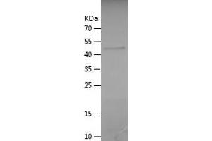 Western Blotting (WB) image for Coiled-Coil Domain Containing 40 (CCDC40) (AA 5-194) protein (His-IF2DI Tag) (ABIN7122430)