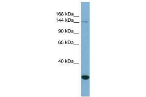 WB Suggested Anti-JARID2 Antibody Titration: 0. (JARID2 anticorps  (N-Term))