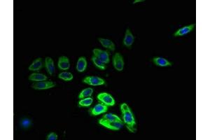 Immunofluorescent analysis of HepG2 cells using ABIN7155229 at dilution of 1:100 and Alexa Fluor 488-congugated AffiniPure Goat Anti-Rabbit IgG(H+L) (HIATL1 anticorps  (AA 450-506))