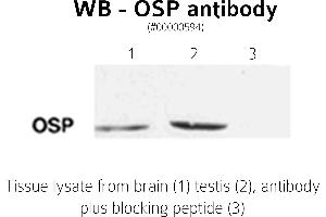 Image no. 2 for anti-Claudin 11 (CLDN11) (C-Term) antibody (ABIN346949) (Claudin 11 anticorps  (C-Term))