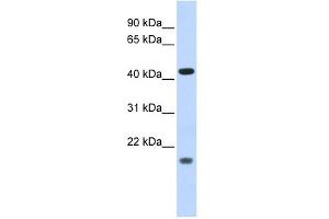 ING3 antibody used at 1 ug/ml to detect target protein. (ING3 anticorps  (Middle Region))