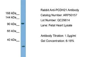 WB Suggested Anti-PCDH21  Antibody Titration: 0. (PCDH21 anticorps  (N-Term))