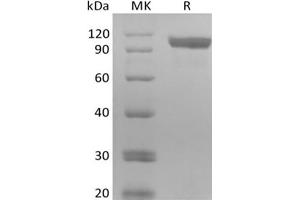 Western Blotting (WB) image for Receptor Tyrosine-Protein Kinase ErbB-3 (ERBB3) protein (Biotin,His-Avi Tag) (ABIN7319879)