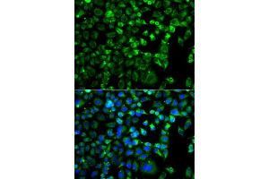 Immunofluorescence analysis of A549 cells using ZAK antibody. (ZAK anticorps)