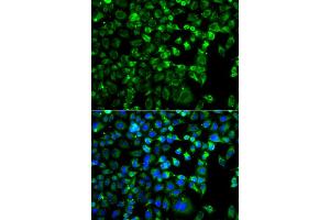 Immunofluorescence analysis of A549 cells using ZAK antibody.