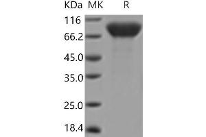 Western Blotting (WB) image for Colony Stimulating Factor 1 Receptor (CSF1R) (Active) protein (His tag) (ABIN7321076)