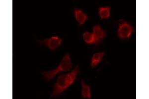 ABIN6266661 staining 293 by IF/ICC. (SUMO1 anticorps  (N-Term))