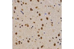 Immunohistochemistry of paraffin-embedded rat brain tissue using PELP1 antibody at dilution of 1:200 (x400 lens). (PELP1 anticorps  (AA 1021-1180))