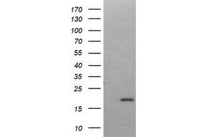 Image no. 1 for anti-LIM Domain Only 2 (Rhombotin-Like 1) (LMO2) antibody (ABIN1499188) (LMO2 anticorps)